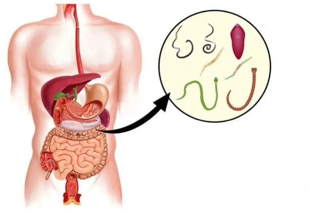 parasites dans différents organes