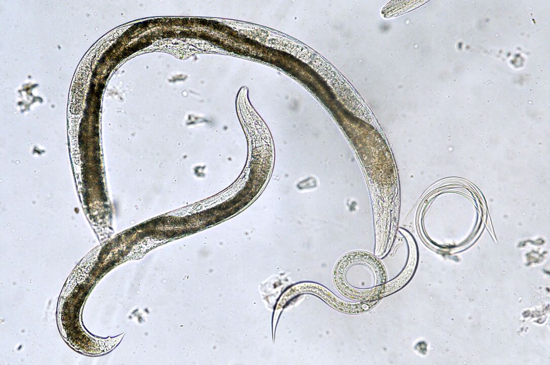 types de parasites qui peuvent s'installer dans le corps