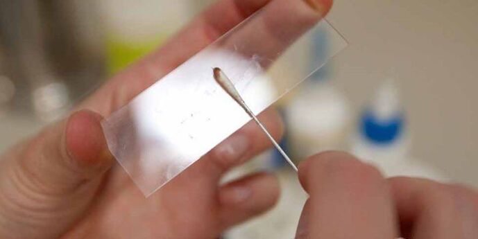 grattage de la peau pour les parasites